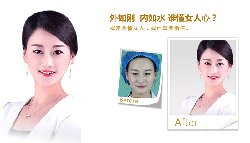 孝感V脸、线雕隆鼻